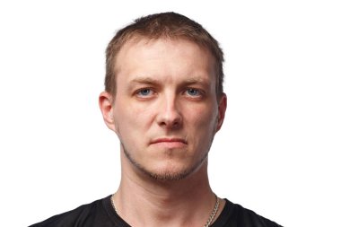 Beyaz arka planda dudağında yara izi olan bir adam resmi