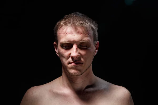 Image of man with scar on lip with closed eyes — Stock Photo, Image