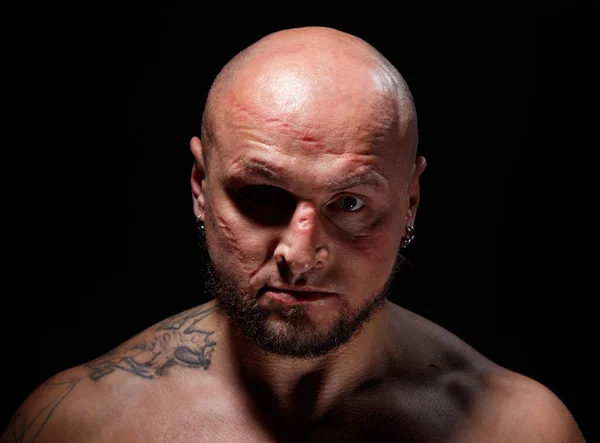 Portrait of bald man with scars on face — Stock Photo, Image