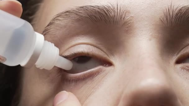 Close-up shooting of young woman with eye drops — Stock Video
