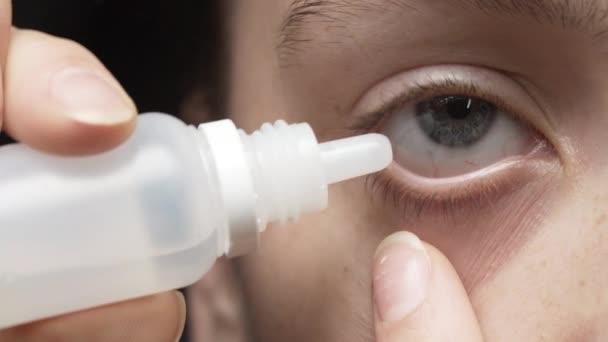 Close-up shooting of young girl with eye drops — Stock Video