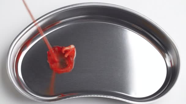 Strzelanie do zakrwawionego zęba mądrości w tacce na nerki — Wideo stockowe
