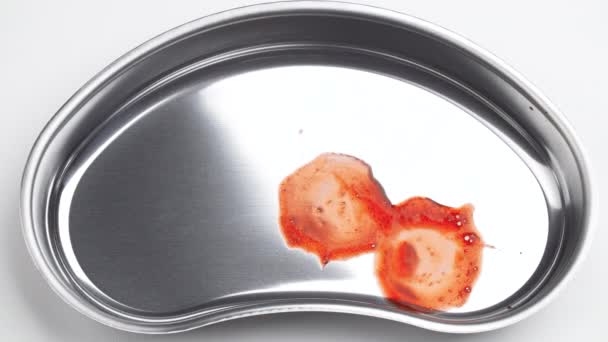 Βίντεο ενός αφαιρεμένου φρονιμίτη σε ένα δίσκο νεφρών — Αρχείο Βίντεο