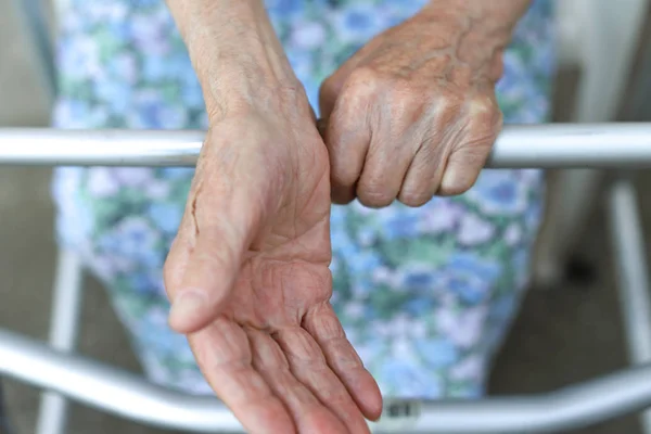 Hand der alten Dame. Eine ältere Dame wartet auf Hilfe. Seniorin erlebt schlechten Service und Bedingungen im Altenpflegeheim. Alterndes Konzept — Stockfoto