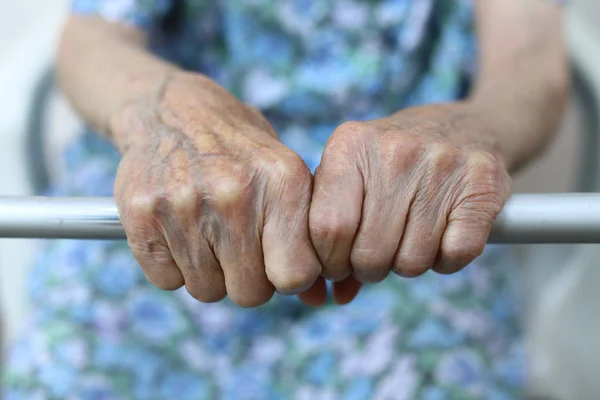 Рука старушки. Пожилая дама ждет помощи. Пожилая женщина испытывает плохое обслуживание и условия в доме ухода за престарелыми. Концепция старения — стоковое фото