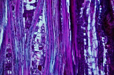 Basswood Kök I. mikroskop altında