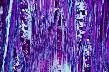 Basswood Kök I. mikroskop altında