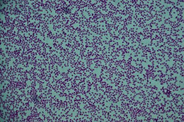 Mikroskop altında balık kanı lekesi