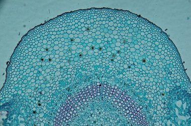 Leiden yaprağı. mikroskop altında