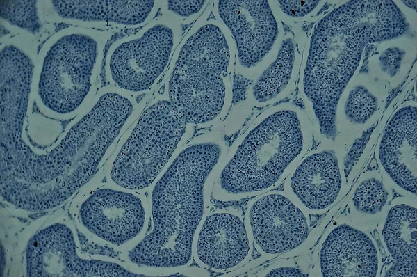 Human Testis Sec Microscope — Stock Photo, Image