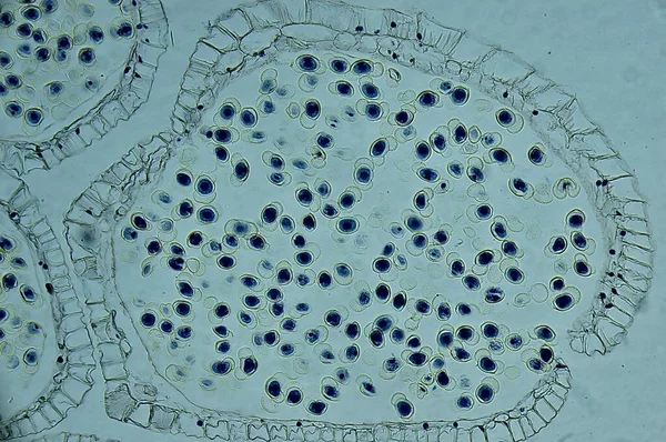 Pinus Male Strobile 현미경으로 — 스톡 사진