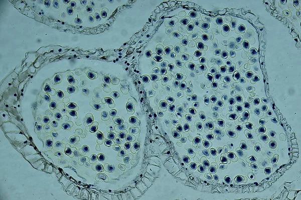 Pinus Estrobílis Masculina Microscópio — Fotografia de Stock