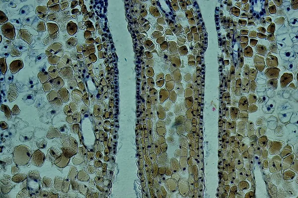 Pinus Estrobílis Feminina Microscópio — Fotografia de Stock