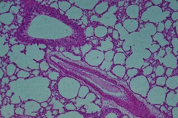 Poumon Rat Avec Arrêts Sanguins Injectés Sec Microscope — Photo