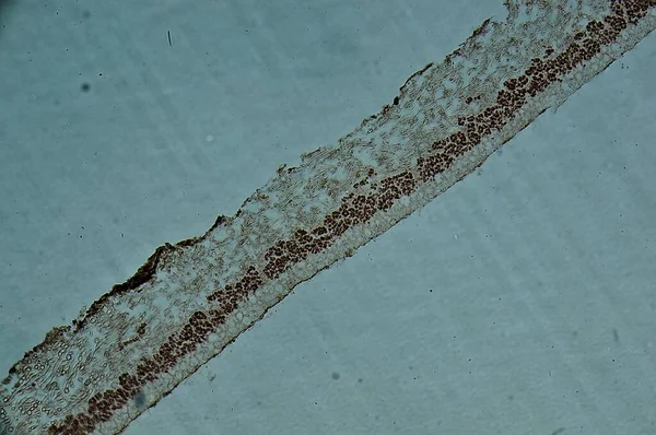 Lichenrons Sekundka Wołu Pod Mikroskopem — Zdjęcie stockowe