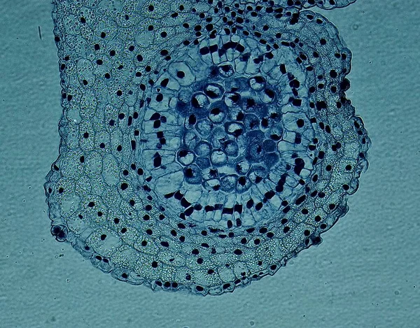 Λίλι Άνθερ Κάτω Από Μικροσκόπιο — Φωτογραφία Αρχείου