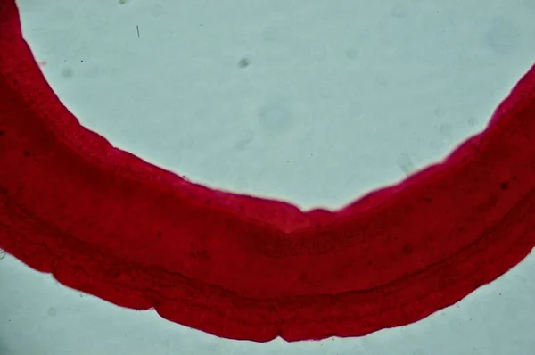 Schistosoma Mężczyzna Pod Mikroskopem — Zdjęcie stockowe