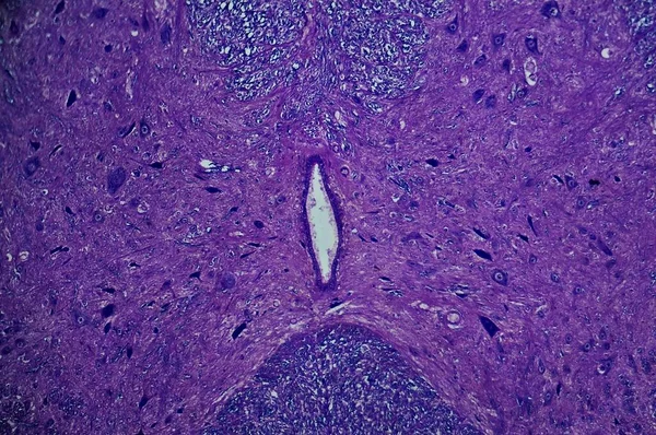 Médula Espinal Bajo Microscopio — Foto de Stock