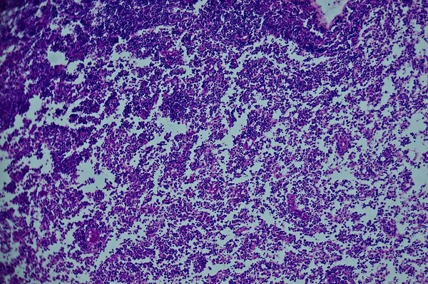 Sekunda Lymfatického Uzlu Pod Mikroskopem — Stock fotografie