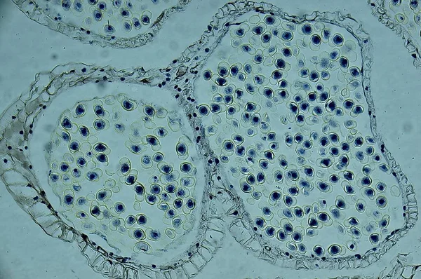 Pinus Estrobílis Masculina Microscópio Fotos De Bancos De Imagens Sem Royalties