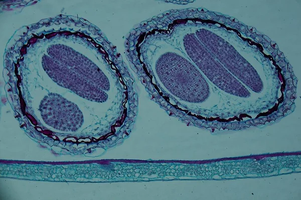 Capsella Alter Embryo Sec Unter Dem Mikroskop — Stockfoto