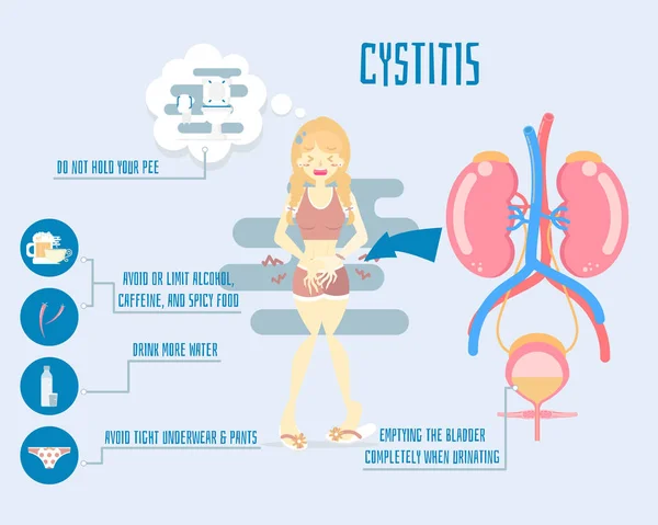 böbrek ve mesane anatomisi ile işemek tutan kadın, sağlık infografik, sistit kavramı, düz karakter tasarım küçük resim vektör illüstrasyon karikatür