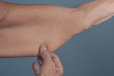 Üst kol yaşlı kadın..