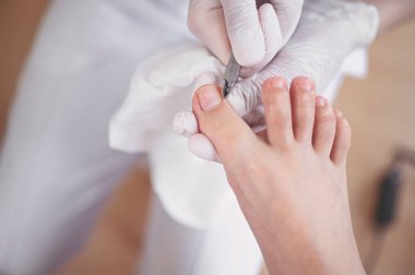 Profesyonel tıbbi pedikür prosedürü tırnak makasıyla kapanır. Hasta ayak hastalıkları uzmanını ziyaret ediyor. SPA salonunda ayak tedavisi. Ayak hastalıkları kliniği. Beyaz eldivenli pedikür elleri