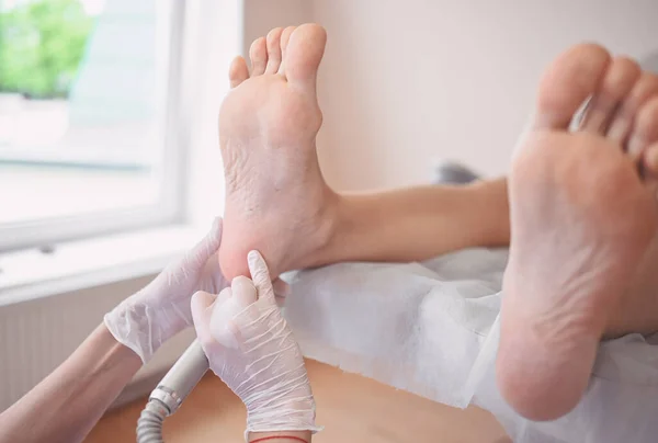 Podiatrist Lekarz Pomocą Sprzętu Szlifierskiego Czyniąc Zabieg Polerowania Stóp Pedicure — Zdjęcie stockowe