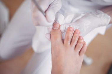 Profesyonel tıbbî pedikür prosedürü çift tırnak aletini kullanarak kapatılıyor. Hasta ayak hastalıkları uzmanını ziyaret ediyor. SPA salonunda ayak tedavisi. Ayak hastalıkları kliniği. Beyaz eldivenli pedikür elleri