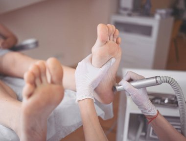 Ayak bileme ekipmanları kullanan ve ayak pedikürü için işlem cilası yapan pediatrist doktor. Beyaz eldivenli Podoloji Güzellik Uzmanı müşteri bacaklarını nasırdan ve mısırdan profesyonel aletlerle temizliyor.