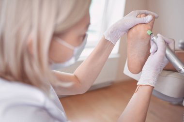 Ayak bileme ekipmanları kullanan ve ayak pedikürü için işlem cilası yapan pediatrist doktor. Beyaz eldivenli Podoloji Güzellik Uzmanı müşteri bacaklarını nasırdan ve mısırdan profesyonel aletlerle temizliyor.