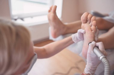 Ayak bileme ekipmanları kullanan ve ayak pedikürü için işlem cilası yapan pediatrist doktor. Beyaz eldivenli Podoloji Güzellik Uzmanı müşteri bacaklarını nasırdan ve mısırdan profesyonel aletlerle temizliyor.