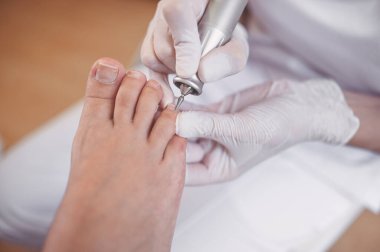 Tırnak törpüsü matkabıyla donanım tıbbi pedikür. Pediyatrist ayak hastalıkları uzmanıyla pedikür tedavisi gören hasta. Özel bir cihazla kaplıcada ayak soyma tedavisi. Podoloji Kliniği.