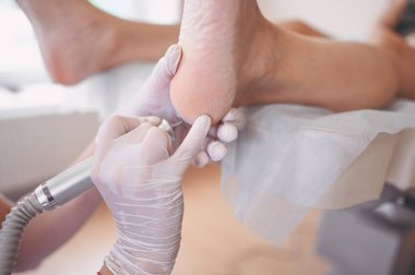Ayak bileme ekipmanları kullanan ve ayak pedikürü için işlem cilası yapan pediatrist doktor. Beyaz eldivenli Podoloji Güzellik Uzmanı müşteri bacaklarını nasırdan ve mısırdan profesyonel aletlerle temizliyor.