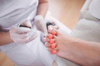 Pedikürcü, ayak parmağı ayırıcı kullanarak hasta bacaklarına beyaz oje sürüyor. Profesyonel tıbbi pedikür prosedürü. SPA salonunda ayak tedavisi. Ayak hastalıkları kliniği. Beyaz eldivenli güzellik uzmanı elleri