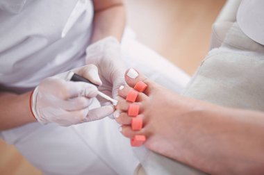 Pedikürcü, ayak parmağı ayırıcı kullanarak hasta bacaklarına beyaz oje sürüyor. Profesyonel tıbbi pedikür prosedürü. SPA salonunda ayak tedavisi. Ayak hastalıkları kliniği. Beyaz eldivenli güzellik uzmanı elleri