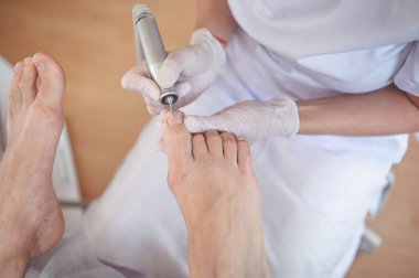 Tırnak törpüsü matkabıyla donanım tıbbi pedikür. Pediyatrist ayak hastalıkları uzmanıyla pedikür tedavisi gören hasta. Özel bir cihazla kaplıcada ayak soyma tedavisi. Podoloji Kliniği.