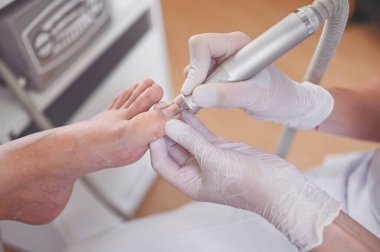 Tırnak törpüsü matkabıyla donanım tıbbi pedikür. Pediyatrist ayak hastalıkları uzmanıyla pedikür tedavisi gören hasta. Özel bir cihazla kaplıcada ayak soyma tedavisi. Podoloji Kliniği.