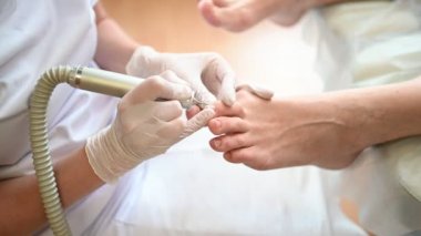 Tırnak törpüsü matkabıyla donanım tıbbi pedikür. Pediyatrist ayak hastalıkları uzmanıyla pedikür tedavisi gören hasta. Özel bir cihazla kaplıcada ayak soyma tedavisi. Podoloji Kliniği