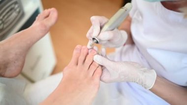 Tırnak törpüsü matkabıyla donanım tıbbi pedikür. Pediyatrist ayak hastalıkları uzmanıyla pedikür tedavisi gören hasta. Özel bir cihazla kaplıcada ayak soyma tedavisi. Podoloji Kliniği