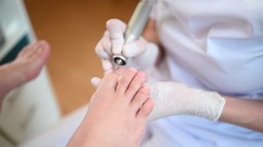 Tırnak törpüsü matkabıyla donanım tıbbi pedikür. Pediyatrist ayak hastalıkları uzmanıyla pedikür tedavisi gören hasta. Özel bir cihazla kaplıcada ayak soyma tedavisi. Podoloji Kliniği