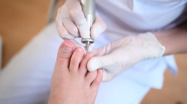 Tırnak törpüsü matkabıyla donanım tıbbi pedikür. Pediyatrist ayak hastalıkları uzmanıyla pedikür tedavisi gören hasta. Özel bir cihazla kaplıcada ayak soyma tedavisi. Podoloji Kliniği