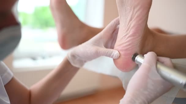 Podiatrist használ csiszoló berendezések és így eljárás lengyel lábpedikűr. Podology kozmetikus fehér kesztyű tisztítása bőr kliens lábak Callus és kukorica professzionális eszközzel. — Stock videók