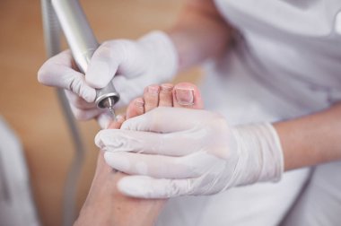 Tırnak törpüsü matkabıyla donanım tıbbi pedikür. Pediyatrist ayak hastalıkları uzmanıyla pedikür tedavisi gören hasta. Özel bir cihazla kaplıcada ayak soyma tedavisi. Podoloji Kliniği.
