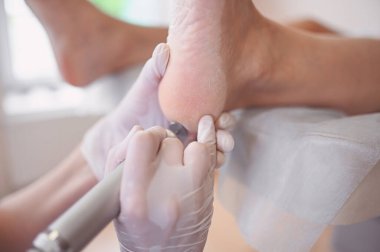 Ayak bileme ekipmanları kullanan ve ayak pedikürü için işlem cilası yapan pediatrist doktor. Beyaz eldivenli Podoloji Güzellik Uzmanı müşteri bacaklarını nasırdan ve mısırdan profesyonel aletlerle temizliyor.