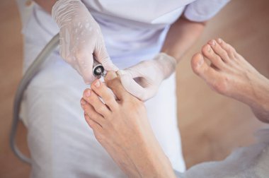 Tırnak törpüsü matkabıyla donanım tıbbi pedikür. Pediyatrist ayak hastalıkları uzmanıyla pedikür tedavisi gören hasta. Özel bir cihazla kaplıcada ayak soyma tedavisi. Podoloji Kliniği.