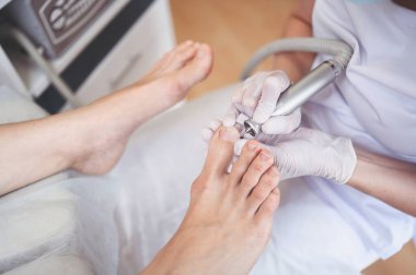 Tırnak törpüsü matkabıyla donanım tıbbi pedikür. Pediyatrist ayak hastalıkları uzmanıyla pedikür tedavisi gören hasta. Özel bir cihazla kaplıcada ayak soyma tedavisi. Podoloji Kliniği.