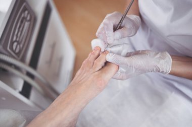 Profesyonel tıbbî pedikür prosedürü çift tırnak aletini kullanarak kapatılıyor. Hasta ayak hastalıkları uzmanını ziyaret ediyor. SPA salonunda ayak tedavisi. Ayak hastalıkları kliniği. Beyaz eldivenli pedikür elleri