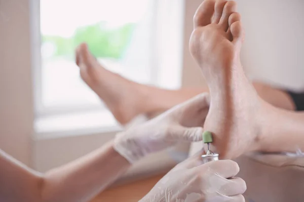 Podiatrist Lekarz Pomocą Sprzętu Szlifierskiego Czyniąc Zabieg Polerowania Stóp Pedicure — Zdjęcie stockowe